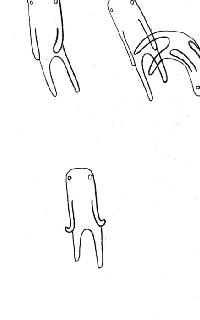 怎么区分湿疹和麻疹,怎么分清湿疹和荨麻疹