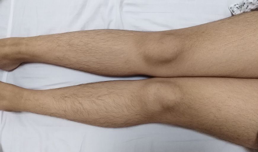 萝莉少女大长腿,为何腿毛长又黑?