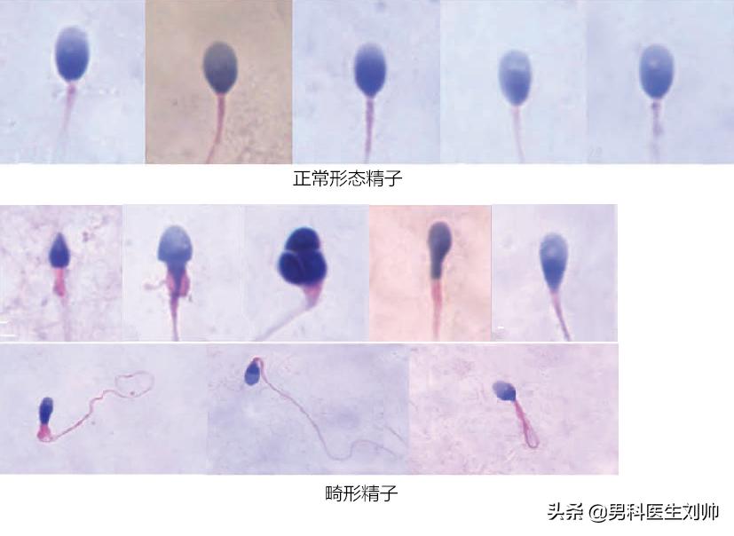 男性科普:精液检查