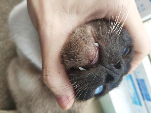 下巴有一块凸起摸着有一个小疙瘩,脸颊靠下巴有个凸起的硬疙瘩