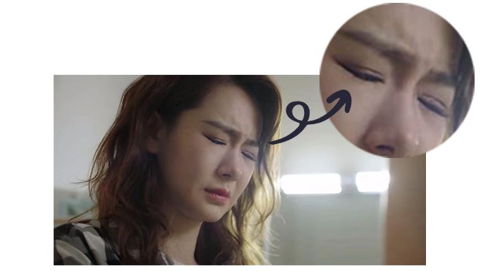 戚薇双眼皮修复视频完整版,戚薇肉条双眼皮是如何恢复的