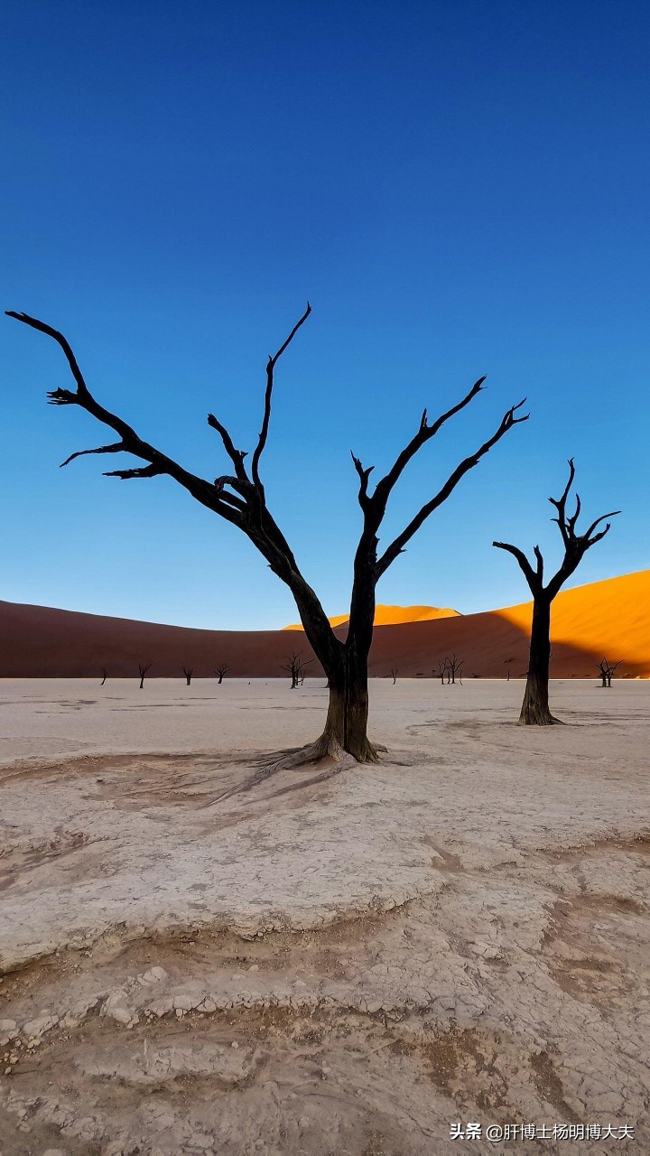 保肝药有哪些,保肝药都有哪些该怎么用