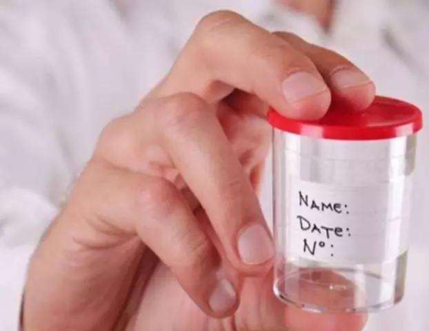 试管精子优化和受精过程,试管人工授精方法