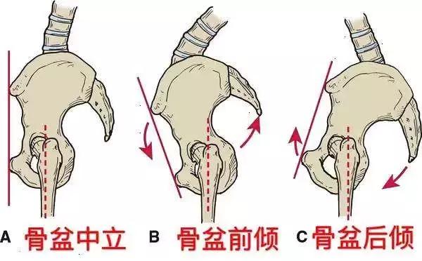 产后康复做坏了,产后恢复讲究这8点你做对了吗