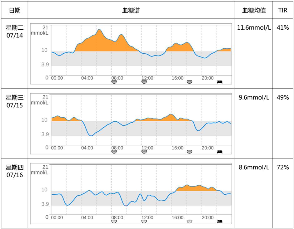反复低血糖是肿瘤吗,读报反复低血糖警惕胰岛素瘤