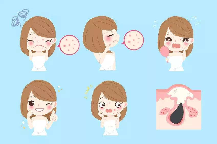 范瑞强治痘痘厉害真的还是假的,中年女性青春痘