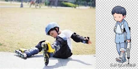 骨折了不长、长得慢怎么办?试试冲击波治疗吧