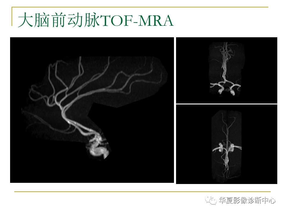 中国人脑立体定向mri应用解剖图谱,脑mri示意图