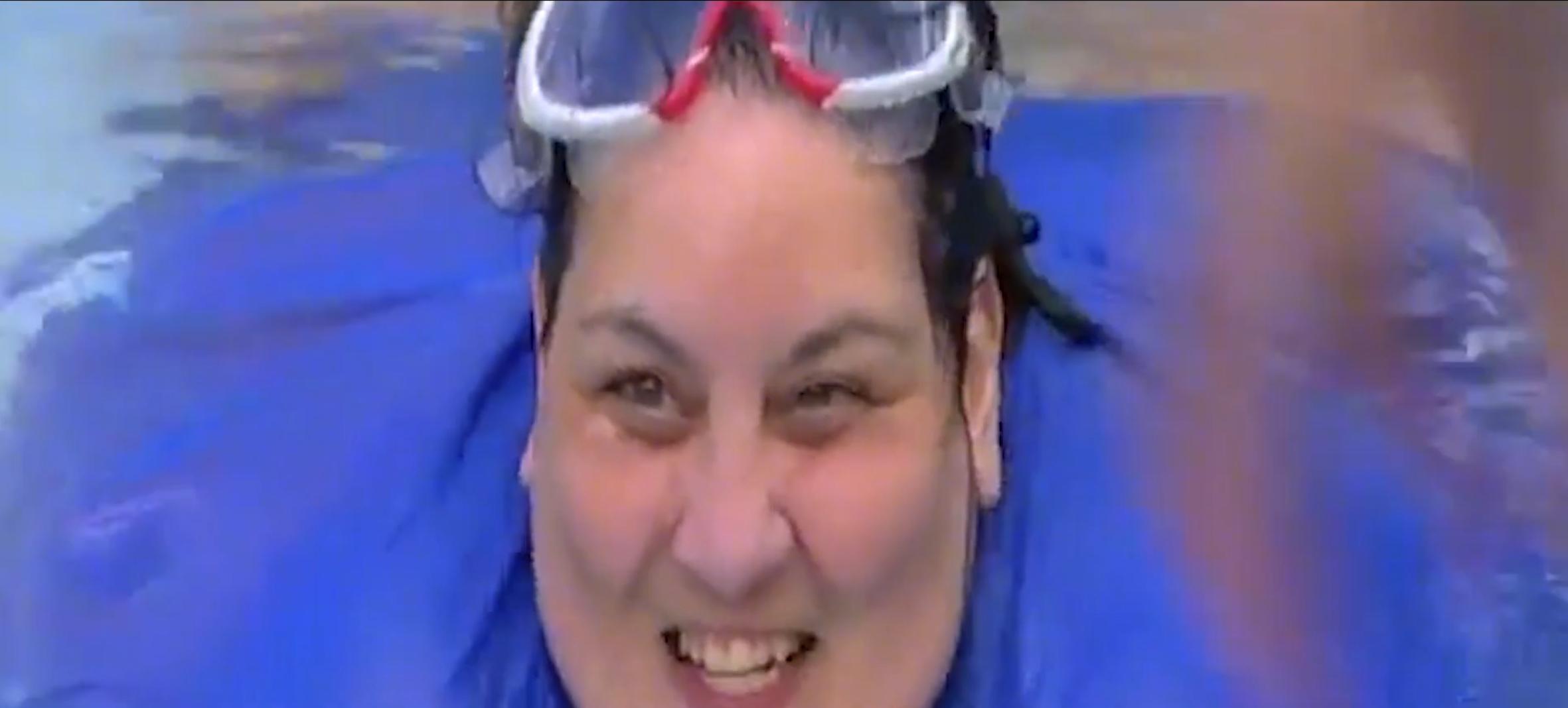 狂吃十年让胖妈器官衰竭，切胃减肥暴瘦66公斤，仍难逃死神索命