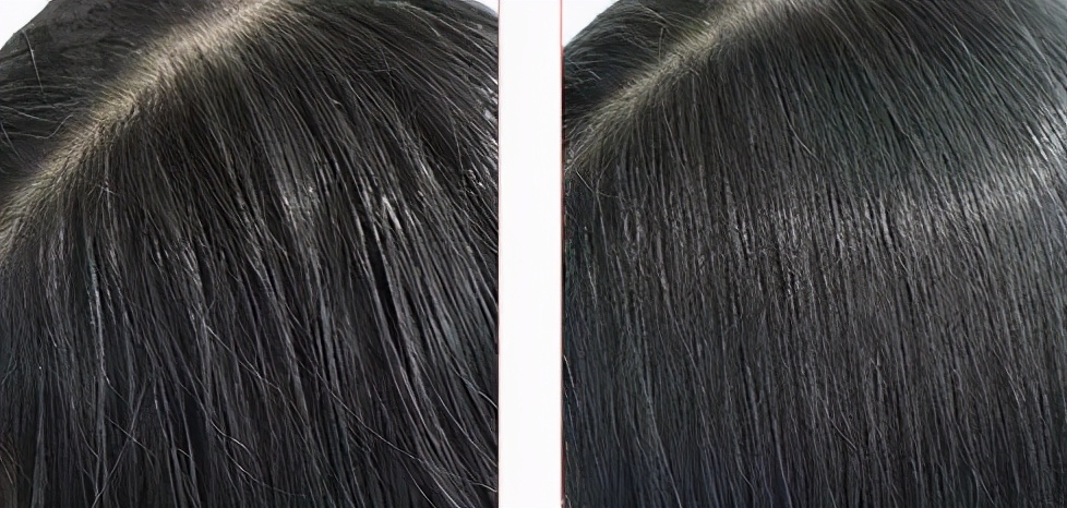 头发爱出油用什么可以变蓬松,头发油怎么才能头发蓬松干爽