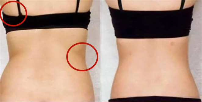 露背怎么穿出美背效果,背肉肉多怎么练