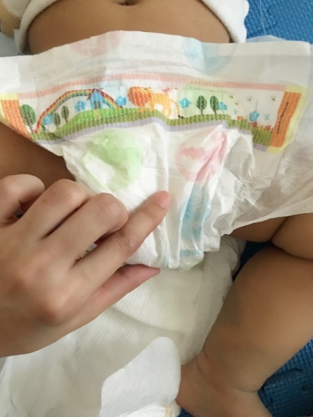 宝宝拉屎漏尿正确方法,宝宝红屁屁漏尿怎么回事