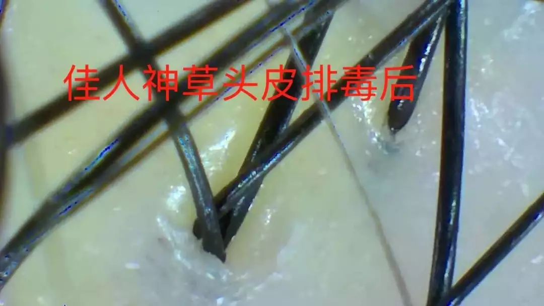 佳人神草侧柏广东广州,生发液评测