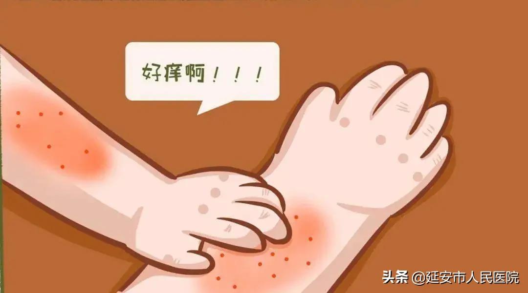 痒到怀疑人生的湿疹，到底该怎么办？