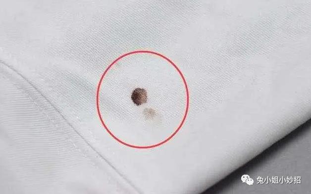 衣服上有血洗不掉怎么办呀,衣服陈旧的血渍84可以清除吗
