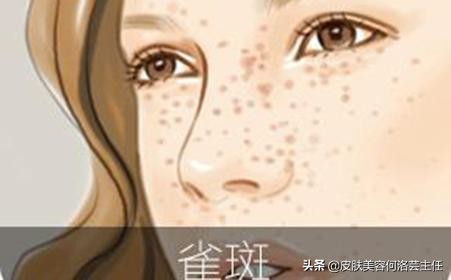 脸上有色斑应该怎么调理,脸上斑越来越多原因及治疗方法