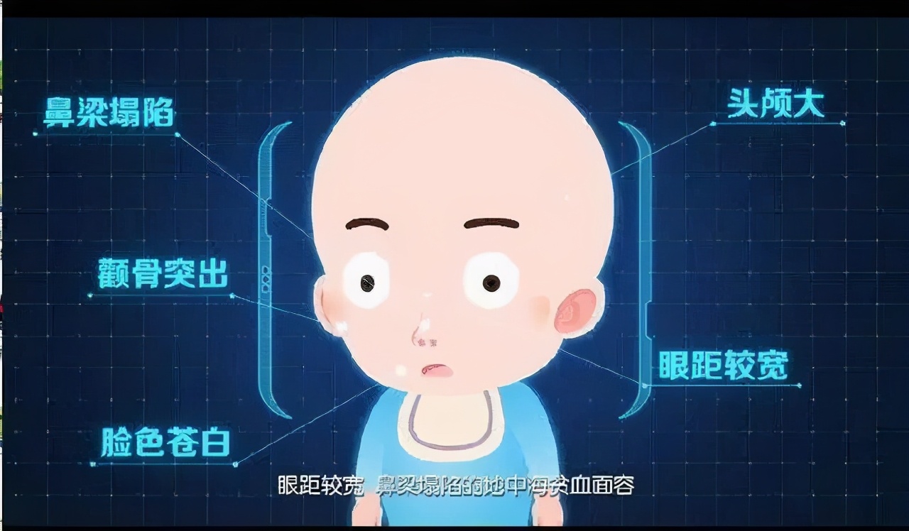 一位地贫患者的自诉，不恨父母，但恨这个疾病