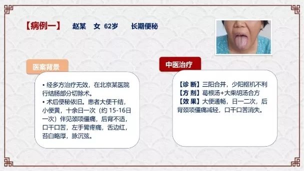 肿瘤与糖尿病的区别,糖尿病与癌症之间回顾性分析