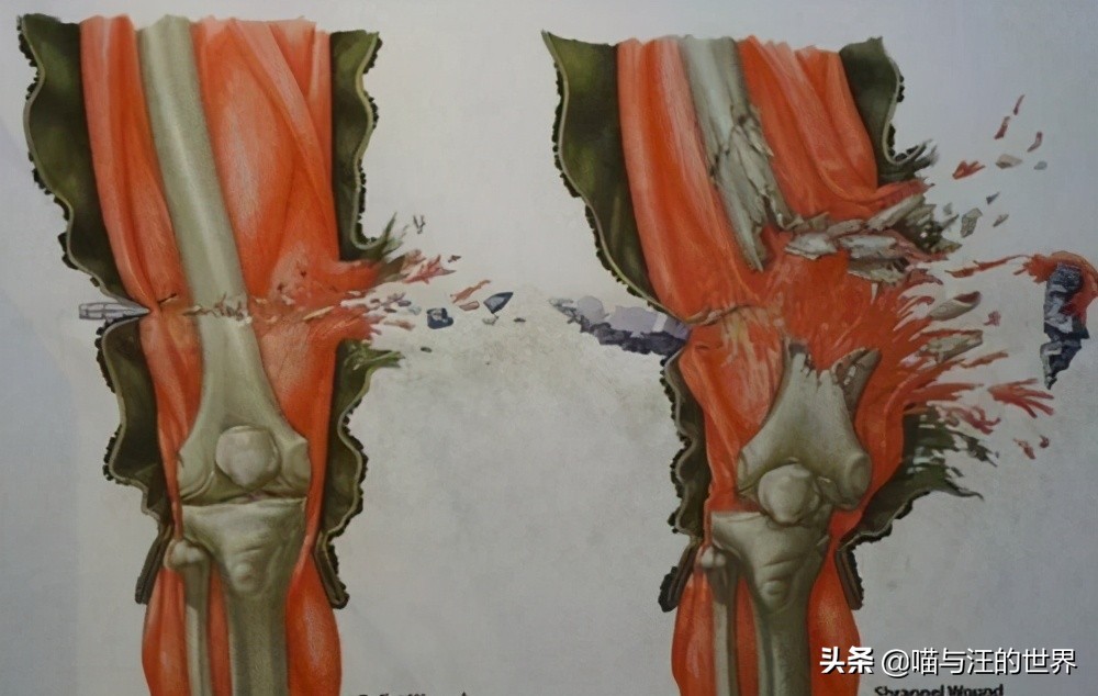 中国军人被子弹击中真实情况,被子弹击中后真实视频