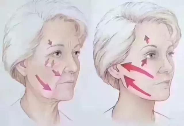 线雕贵还是玻尿酸贵,线雕的线贵不贵