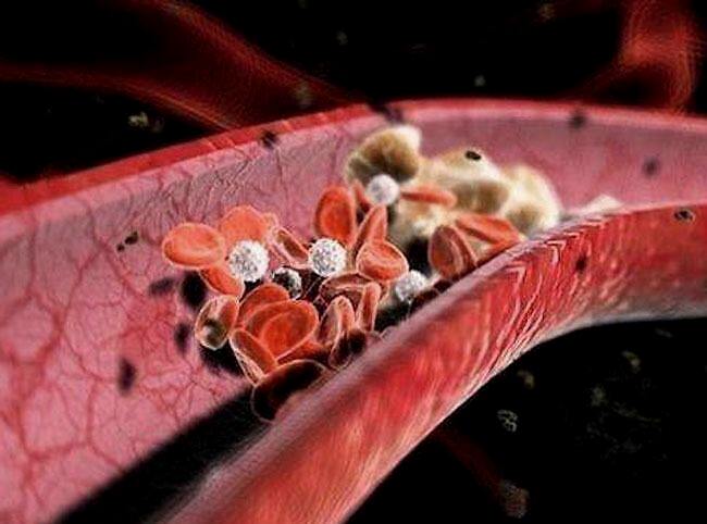 胆结石症状有哪些吃什么药,胆结石有什么症状要吃药吗