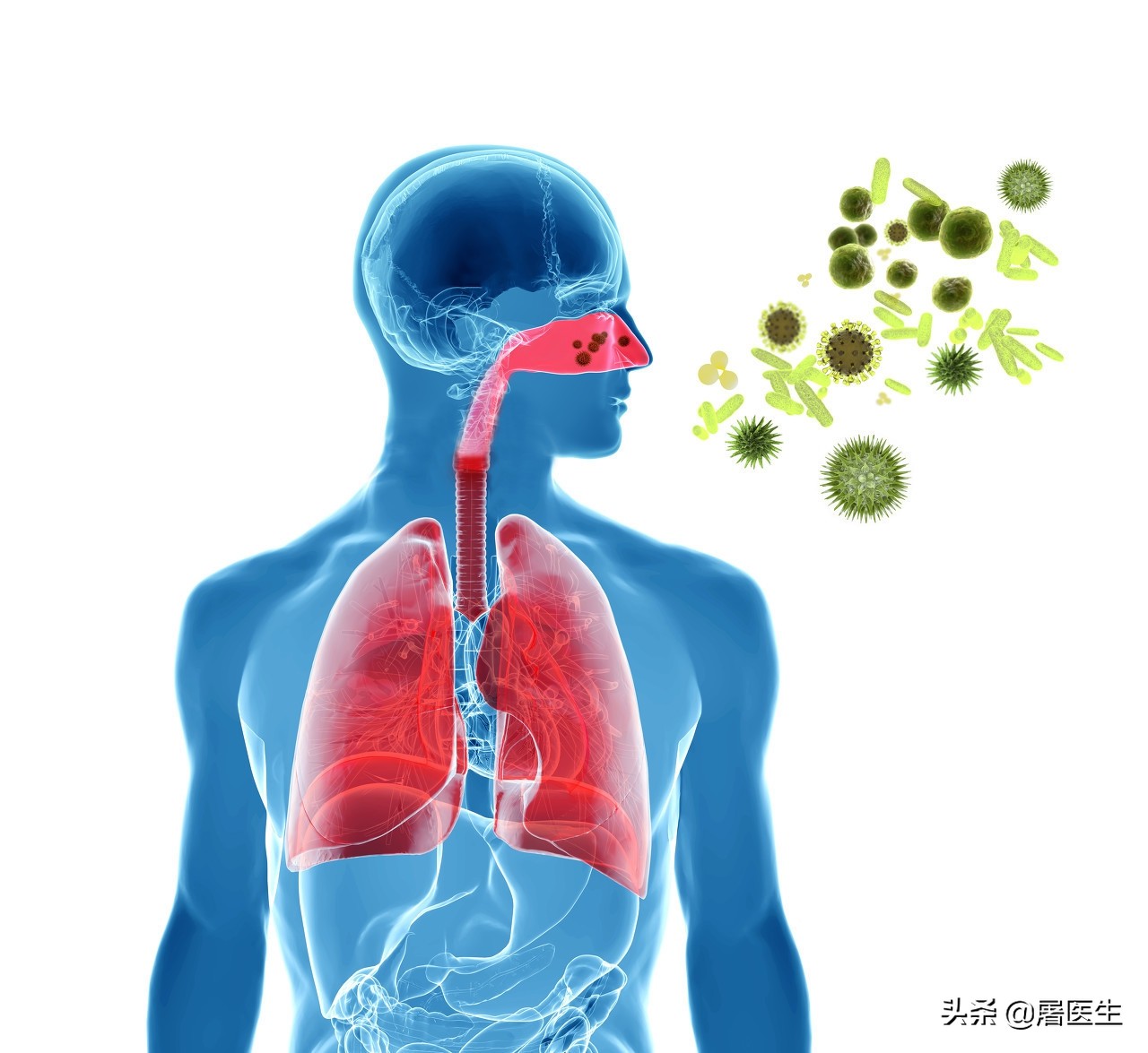 布鲁菌病的临床特点与防治,布鲁菌病简介