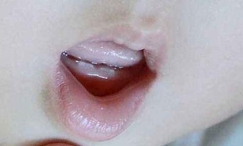 1岁宝宝总是有意无意撅嘴,1岁宝宝总使劲咧嘴