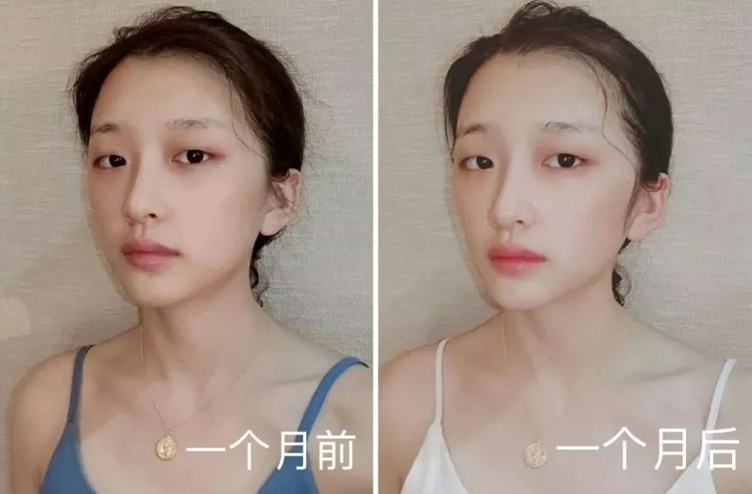 大饼脸用什么减肥方法,减肥圆脸变v字脸效果好吗