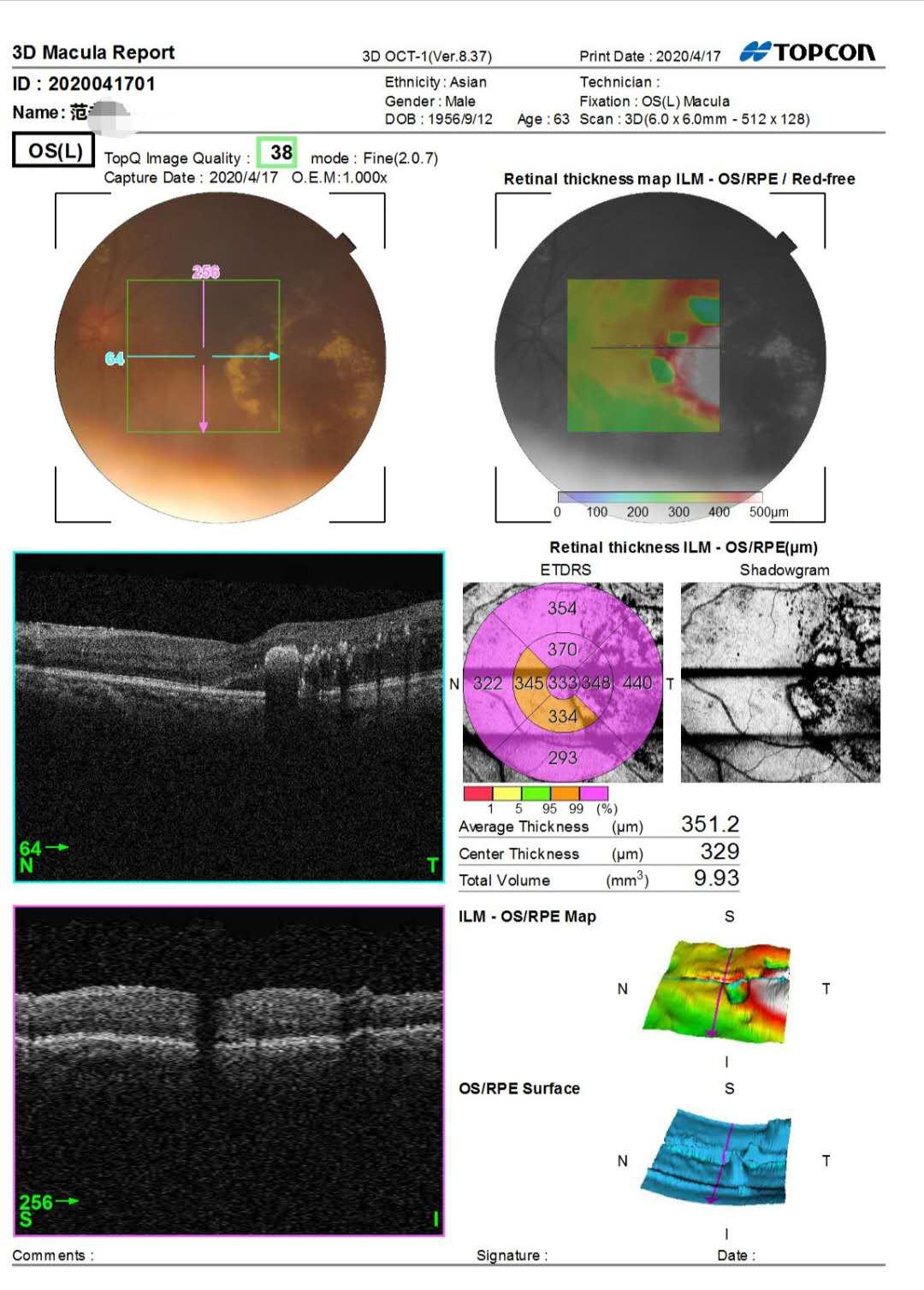眼科先天性眼底病变,眼底病变医院