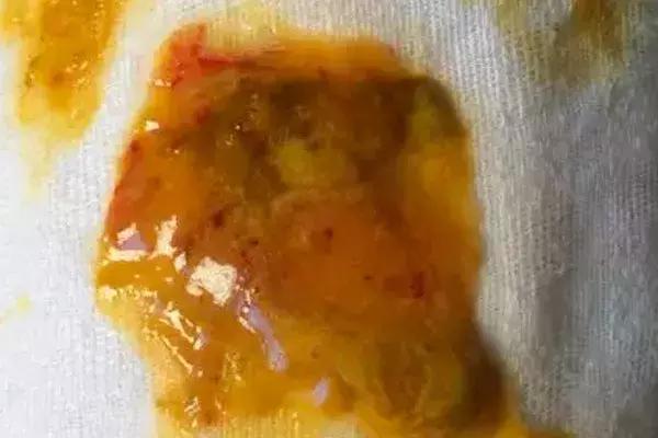 新手爸妈稳住！手把手教你看懂千姿百态大便便（超全观察指南）