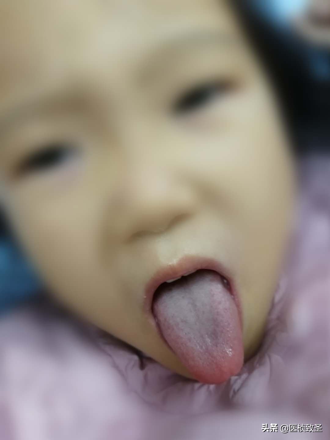 提高孩子免疫力吃10天停20天,孩子总是感冒咳嗽怎么提高免疫力