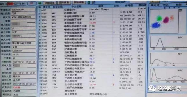 “秒”看血小板聚集，你get到了吗？