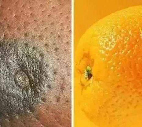 免费！不限户籍！35-64岁女性可享“两癌”筛查！