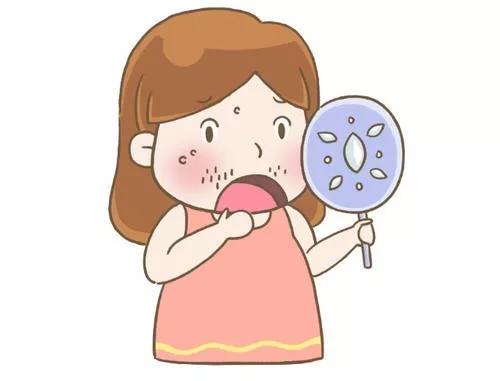 月经后错、多毛、长痘、肥胖,警惕多囊卵巢综合征