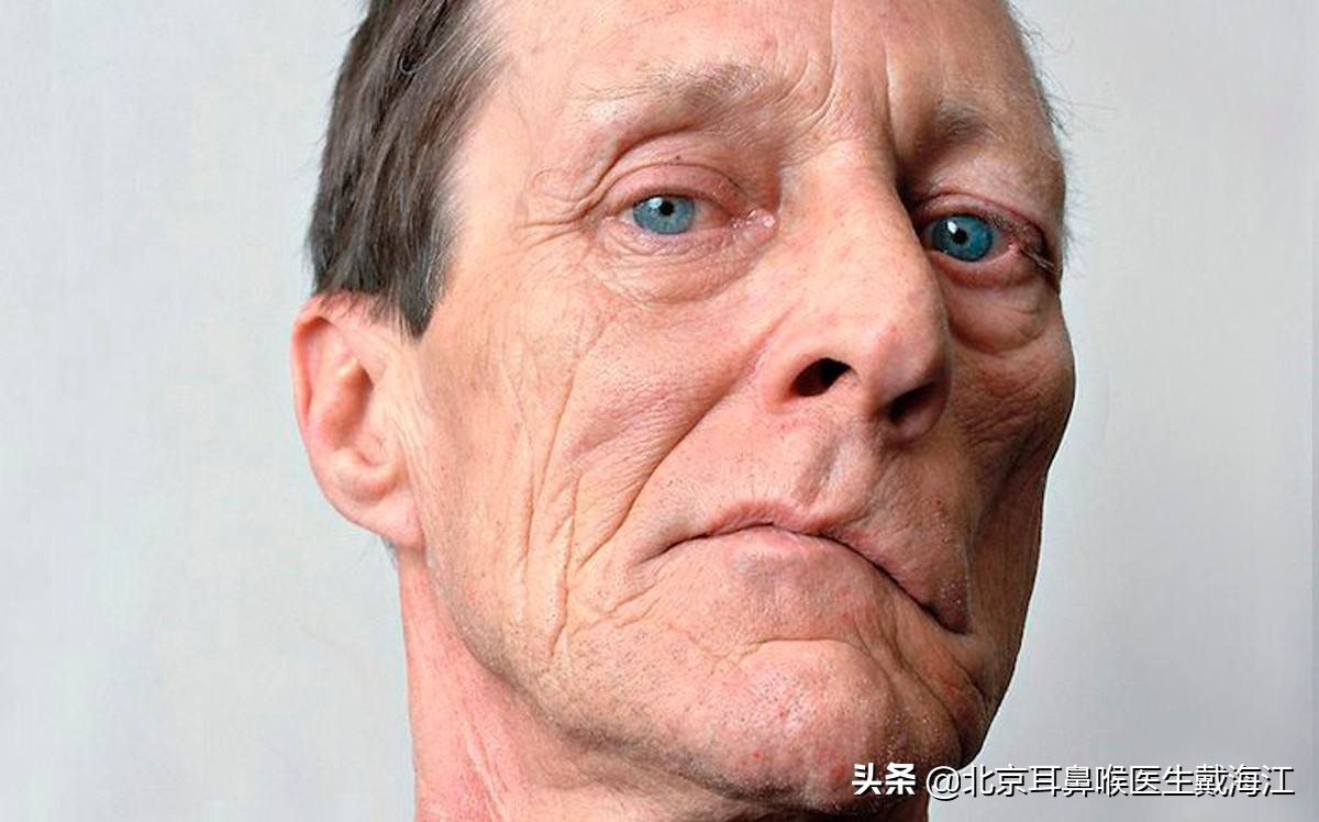 不爱笑是面瘫吗,不爱笑是什么类型的脸