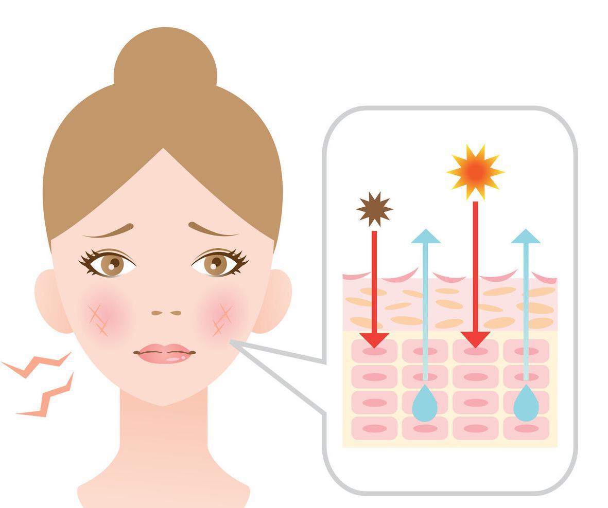 新生儿皮肤红血丝明显,皮肤出现红血丝还很痒怎么办