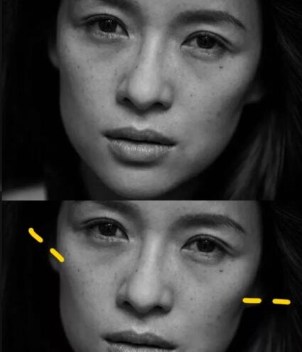 太阳穴凹陷颧弓外扩怎么画眉毛,太阳穴凹陷颧弓突出明显怎么化妆