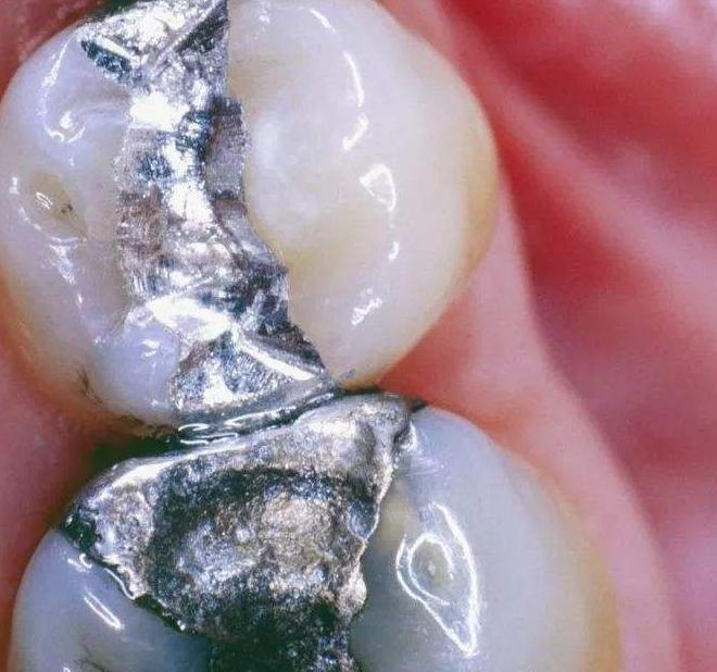 你的牙齿变黄了怎么办,你的牙齿为什么会那么白