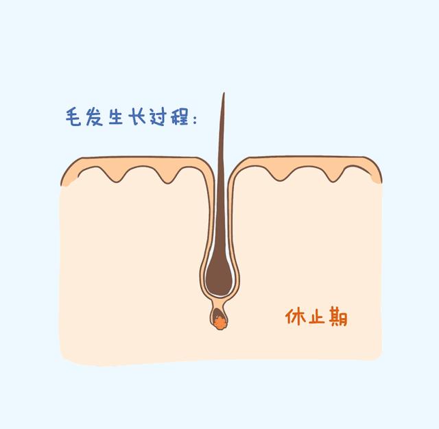 女性雄激素性脱发（脂溢性脱发）的常用治疗药物有哪些？