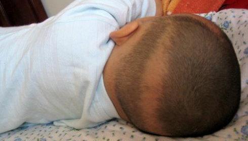 小月龄宝宝掉头发枕秃,3个半月宝宝头上出现胎痂怎么办
