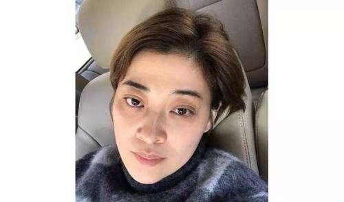 黑眼圈熊猫眼怎么补救,为什么有的人不熬夜也会有黑眼圈