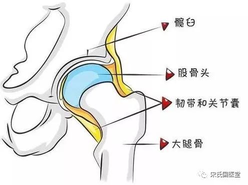 股骨头坏死漏诊图片,太康陈医生治疗股骨头坏死