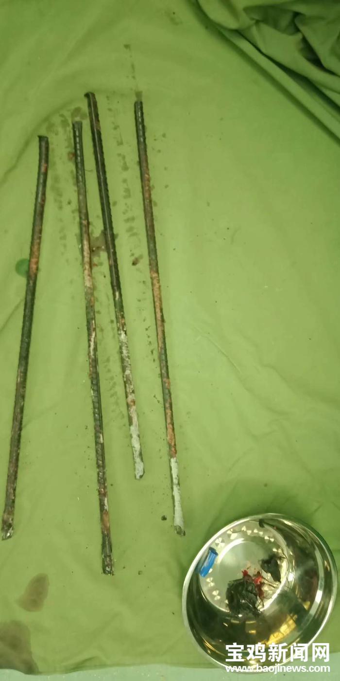 钢筋插入工人身体医生消防齐施救,钢筋贯穿身体多科室进行联合抢救