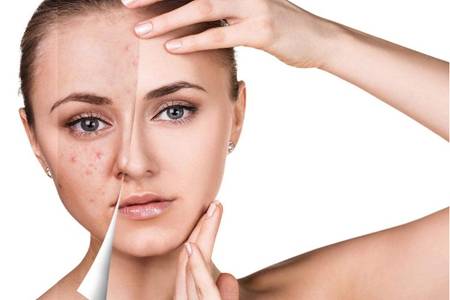 鼻子上长很多痘痘怎么办最快消除,如果鼻头上一直长痘如何改善