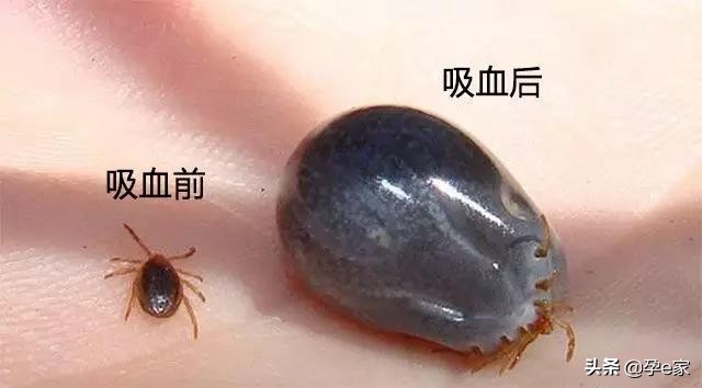 身上出现许多小黑痣,身上出现凸起黑痣一定要重视