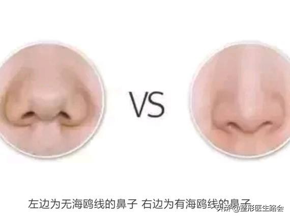 你的鼻子是怎样的,你的鼻子是什么的形状