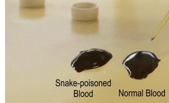 印度男咬死眼镜蛇,印度男子咬死眼镜蛇