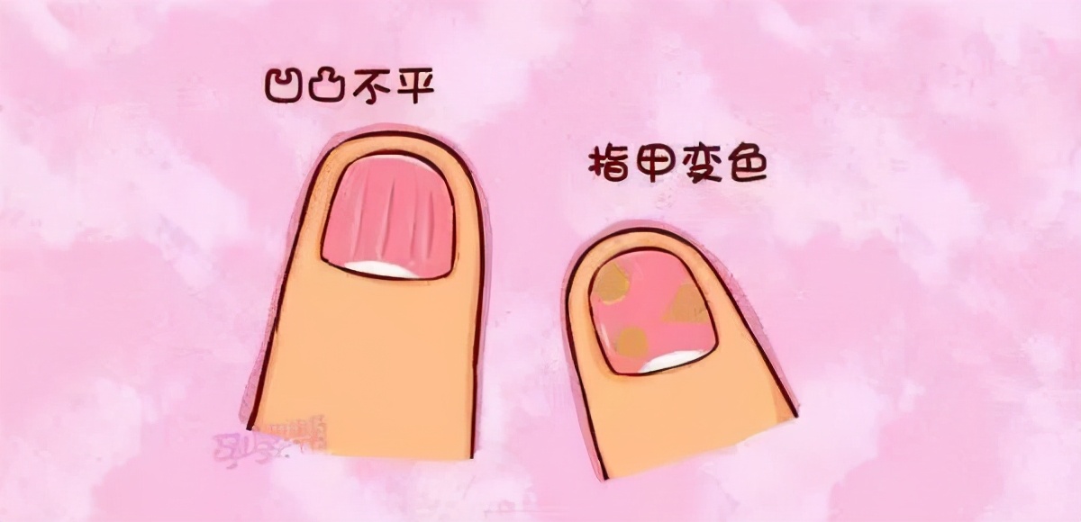 如何从指甲看出自己的健康状况,真正的健康真相你知道吗