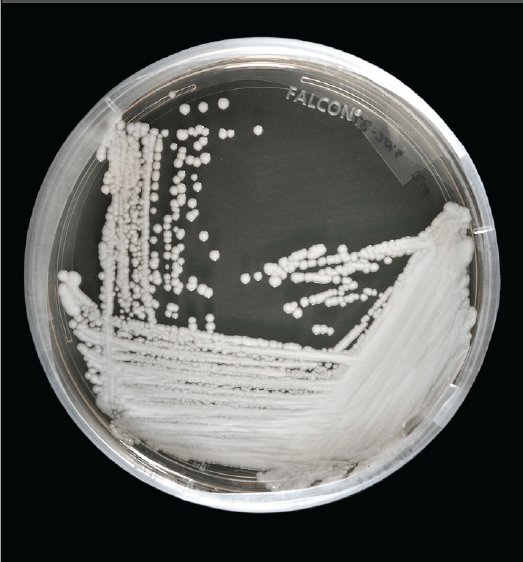 超级真菌如何应对,超级真菌最新官方消息