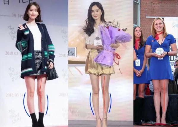 腿不直小腿外翻可以矫正过来吗,坐着改善小腿外翻明星